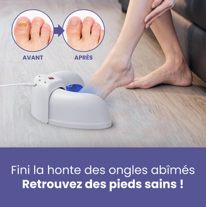 ClearNail Pro™ Dispositif laser pour les mycoses de l'ongle | Élimine 99,9 % des mycoses en 7 jours